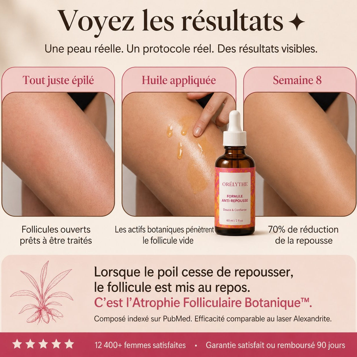 Orélythe™ — Formule Anti-Repousse
